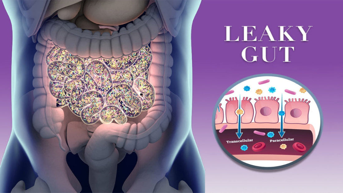 Struggling with Leaky Gut? Here’s What Actually Works